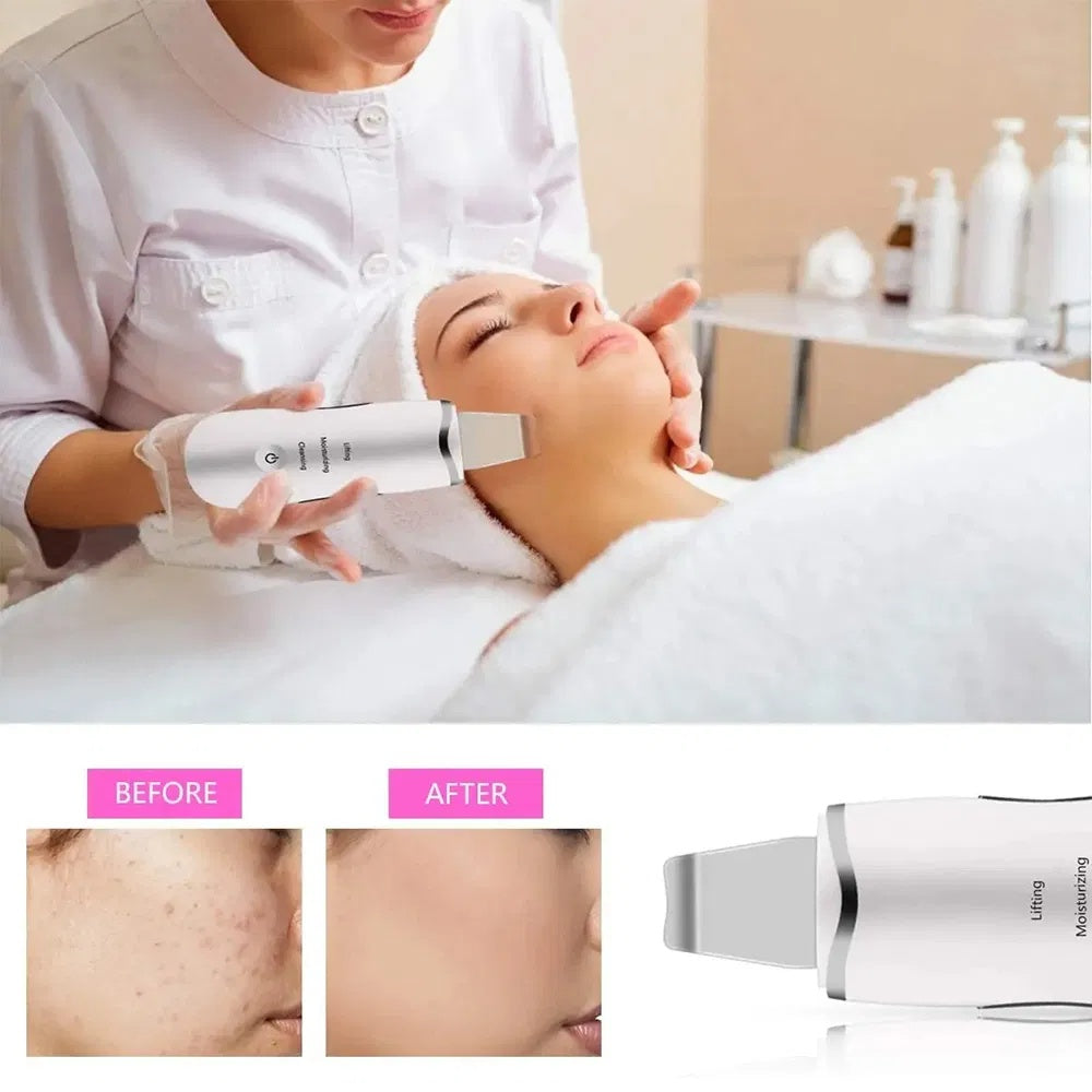 Electric Ultrasonic Skin Scrubber
