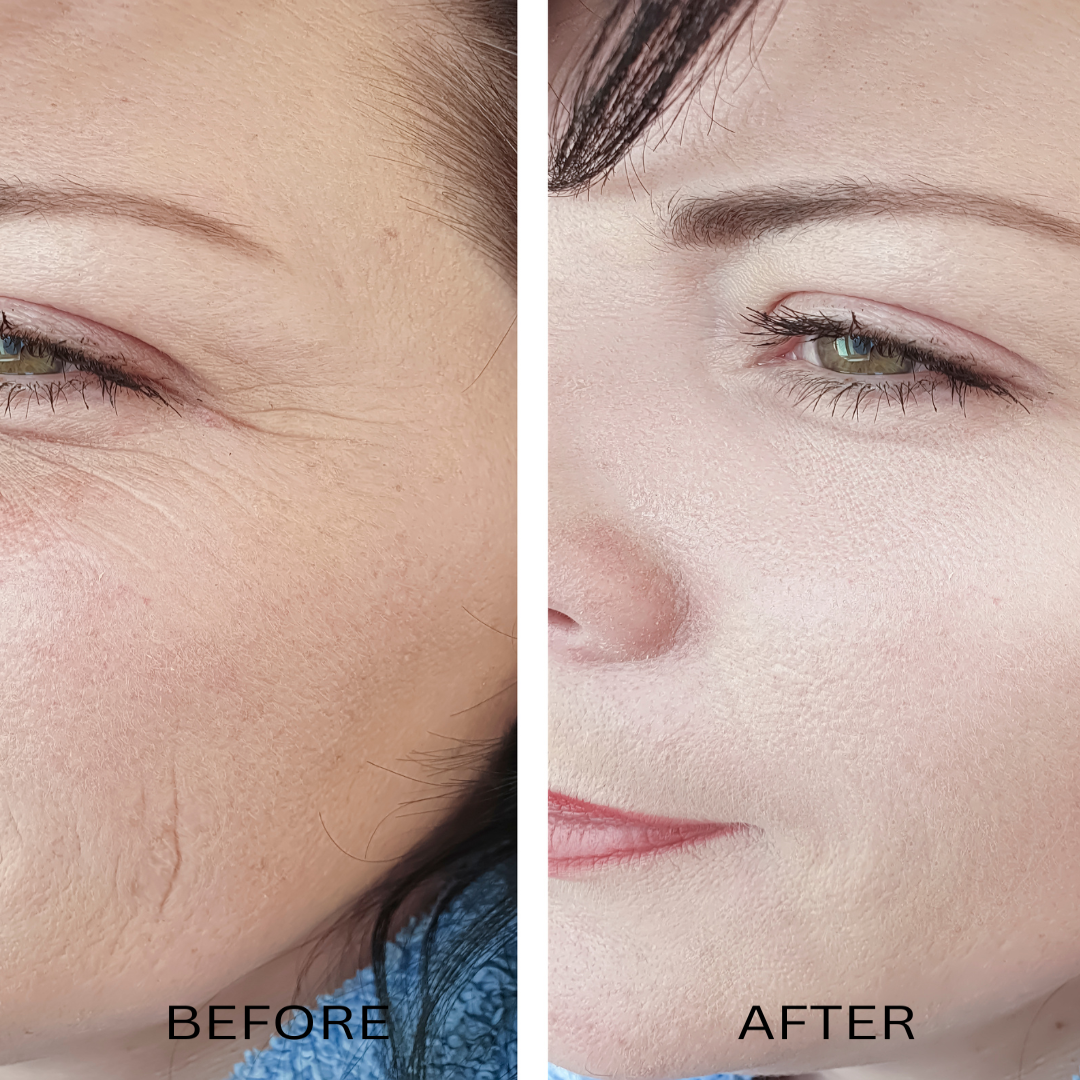ORGANIC HYALURONIC WRINKLE DEFIER -  For Women and Men-2
