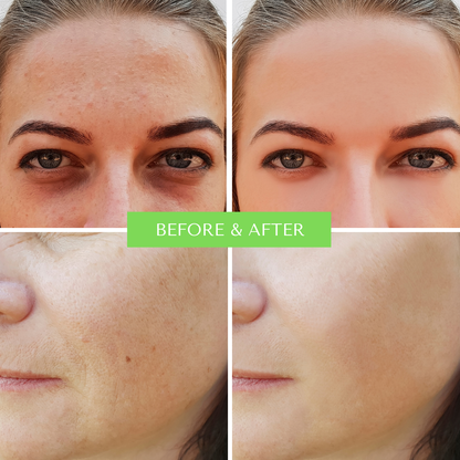 ORGANIC HYALURONIC WRINKLE DEFIER -  For Women and Men-1