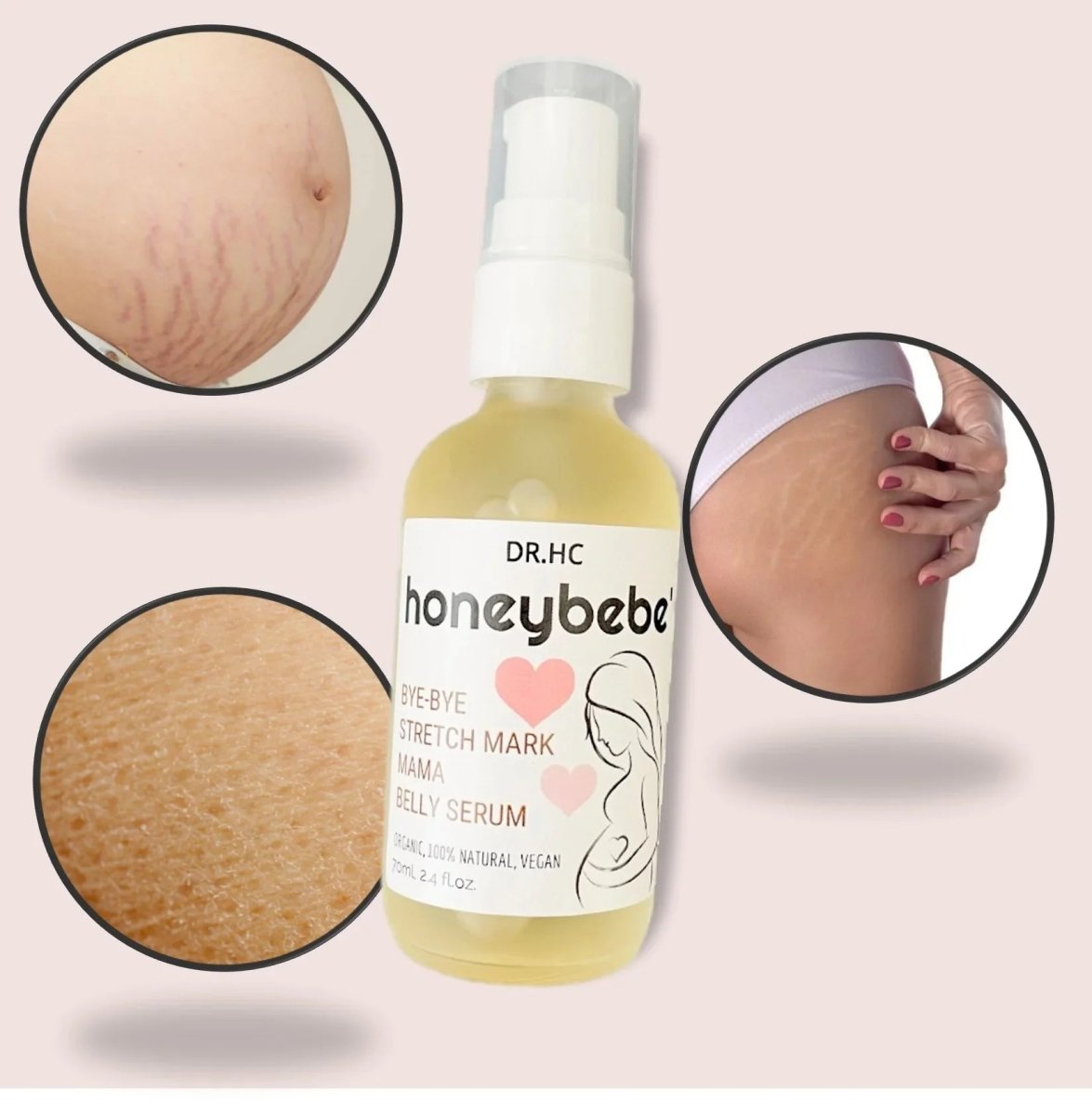 DR.HC Honeybebe' Bye-Bye Stretch Mark Mama Belly Serum (100% Organic, Natural & Vegan) (70ml, 2.4 fl.oz.) (Stretch Mark Prevention & Removal)Pregnancy