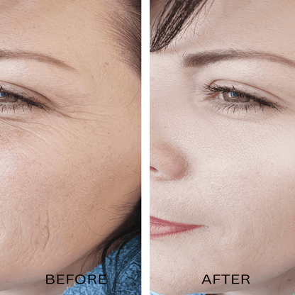 ORGANIC HYALURONIC WRINKLE DEFIER - For Women and MenHyaluronic Wrinkle Defyer Spritz