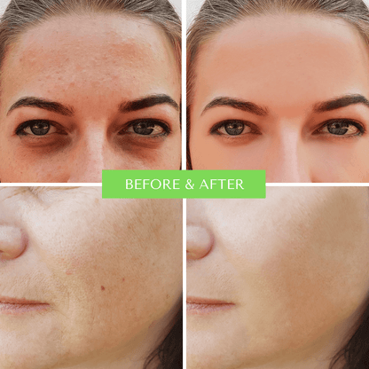 ORGANIC HYALURONIC WRINKLE DEFIER - For Women and MenHyaluronic Wrinkle Defyer Spritz