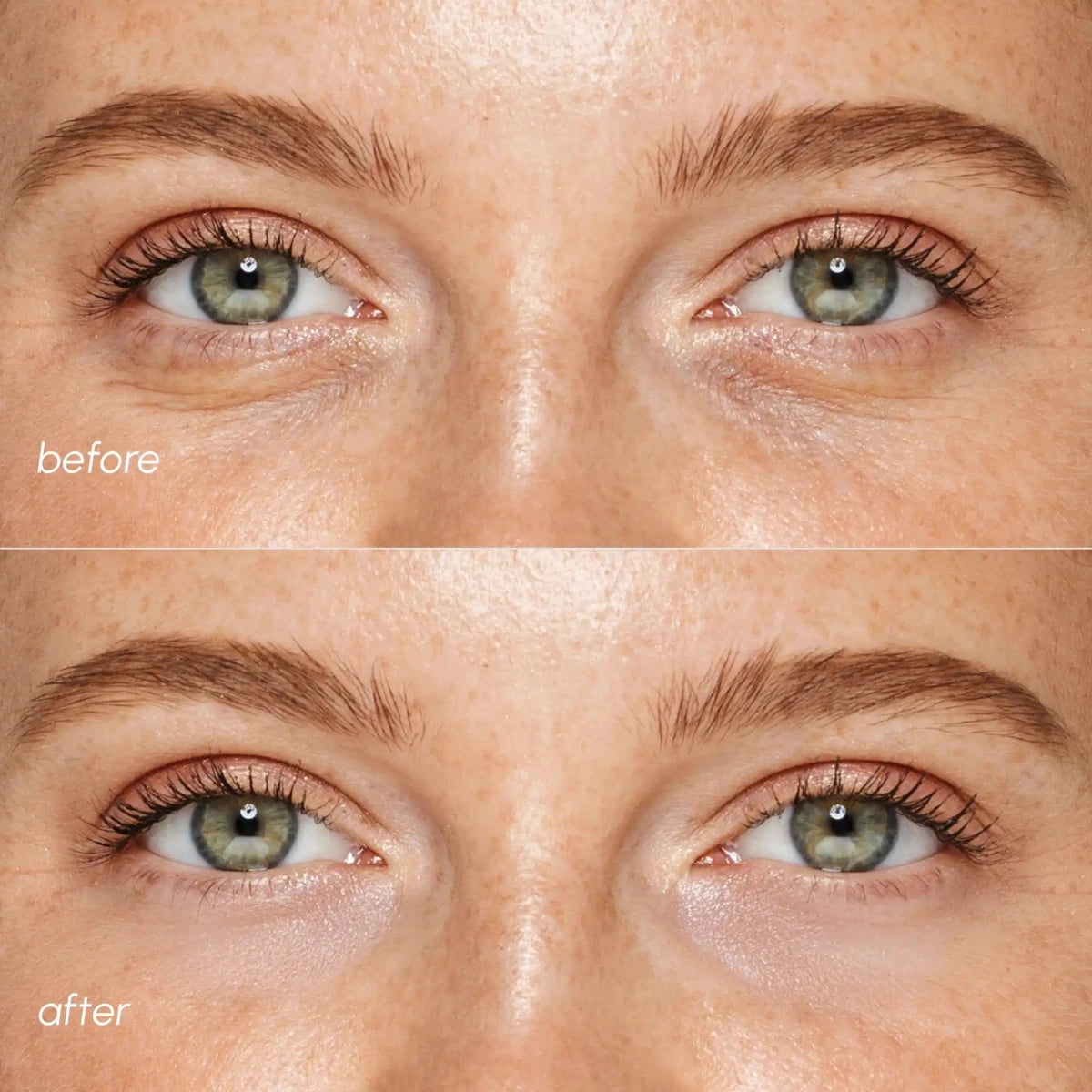 Pink Eye Patches for Puffy Eyes