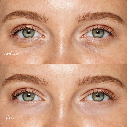 Pink Eye Patches for Puffy Eyes